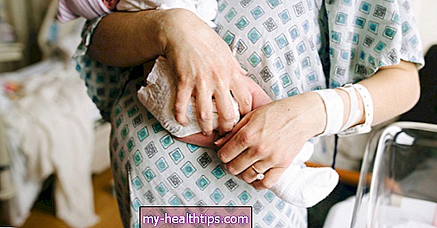 Kaip pilvo įrišimas gali padėti atsigauti po gimdymo