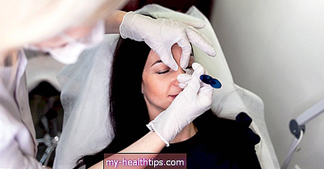 Cómo puede ayudar el Botox a deshacerse de las líneas de conejito