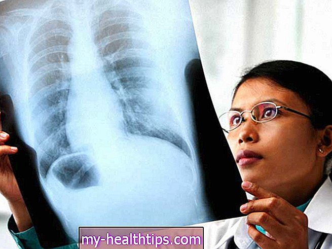 Wie helfen Röntgenstrahlen bei der Diagnose von COPD?