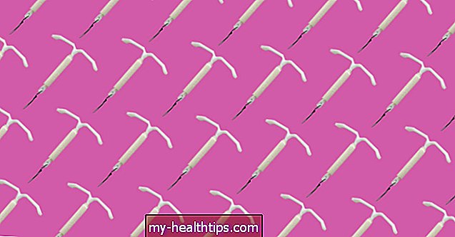 Kuinka Mirena-kela (IUD) vaikuttaa vaihdevuosiin?