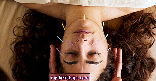 음당 침술은 어떻게 작용합니까?
