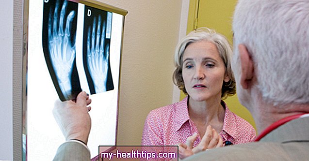 Kaip diagnozuojamas reumatoidinis artritas?