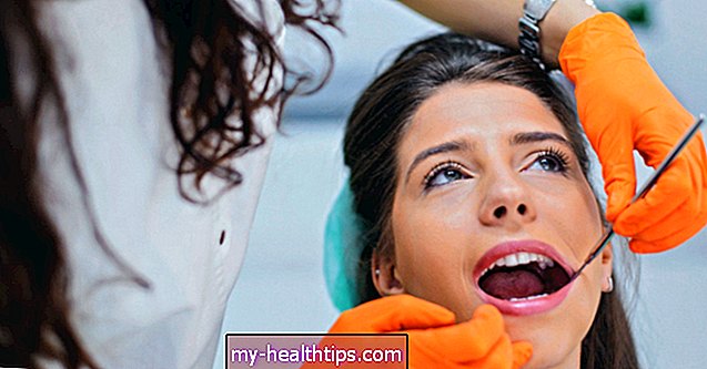 Колико дуго након вађења зуба можете добити суву чахуру?