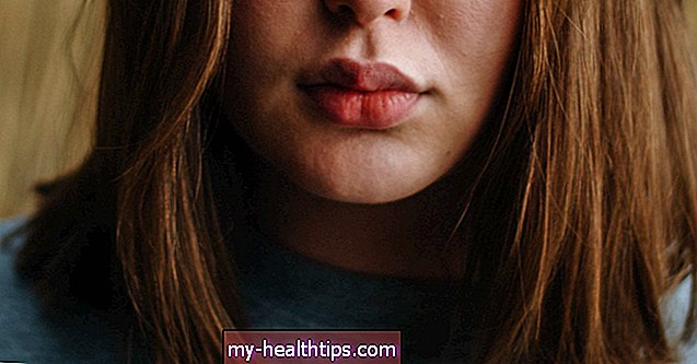 ¿Cuánto duran los rellenos de labios?