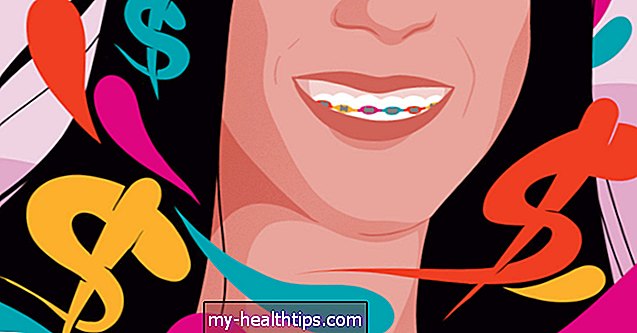 كيف أصبحت أسناني المستقيمة رمزًا للثروة