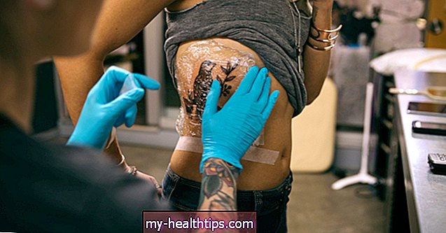 Kaip gydo tatuiruotes