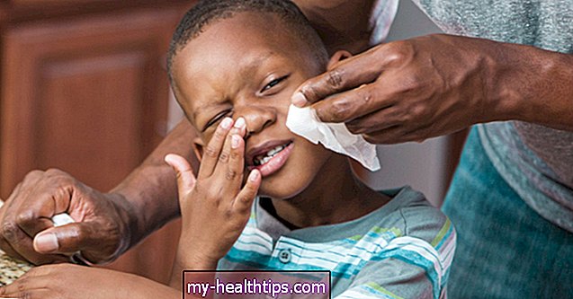 Cómo el saludo alérgico está arrugando la nariz