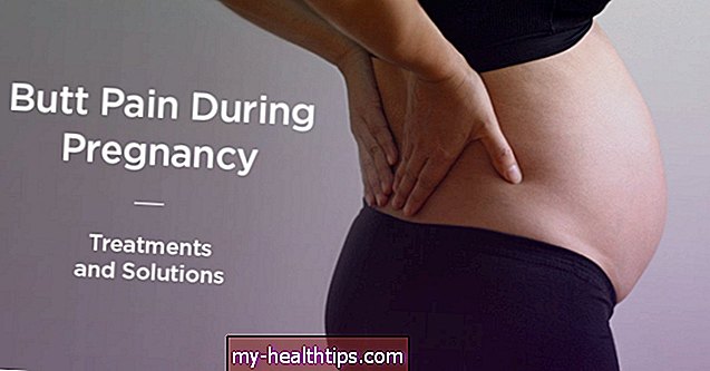 Kaip elgtis su užpakalio skausmu nėštumo metu