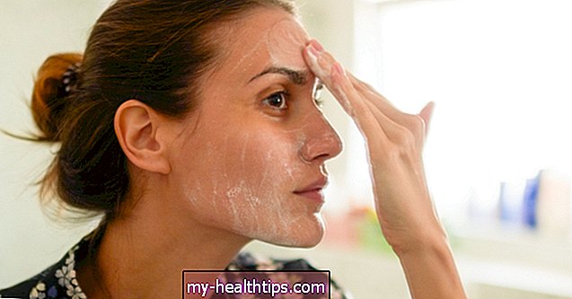 Kaip greitai atsikratyti veido odos šveitimo