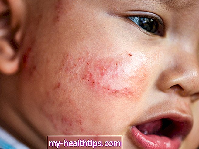 Cómo saber si tu bebé tiene piel sensible
