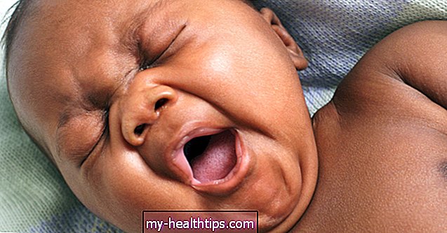 Kaip atpažinti pervargusį kūdikį