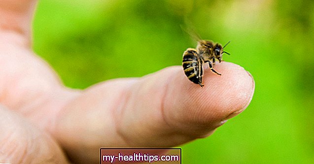 Kaip pašalinti bičių smaigalį