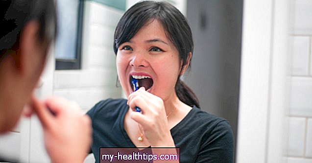 Cómo detener su hábito de chuparse la lengua