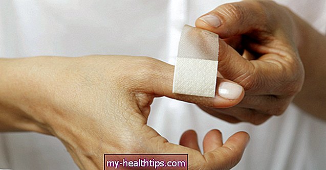 Како третирати крварење на прсту: детаљна упутства