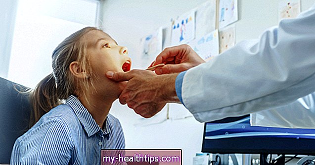 Kaip gydyti ir užkirsti kelią liežuvio siautėjimo sąlygoms
