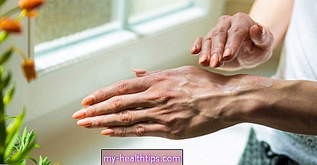 स्वाभाविक रूप से त्वचा हाइपरपिगमेंटेशन का इलाज कैसे करें