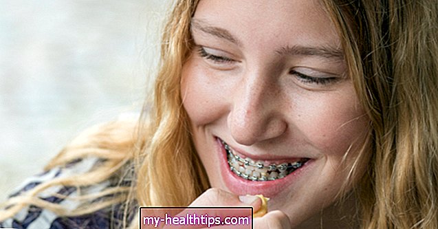 Wie man geschwollenes Zahnfleisch mit Zahnspangen behandelt