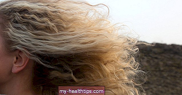 Kaip naudoti galvos odos baliklį, norint saugiai nuspalvinti plaukus