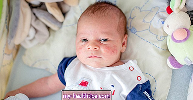 Virusinių bėrimų nustatymas ir diagnozavimas kūdikiams