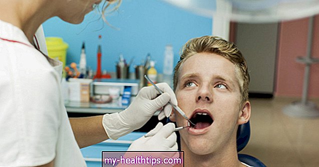 Pažeistų dantų nustatymas ir gydymas