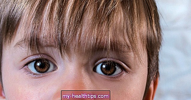 Идентификовање и лечење ружичастог ока код деце