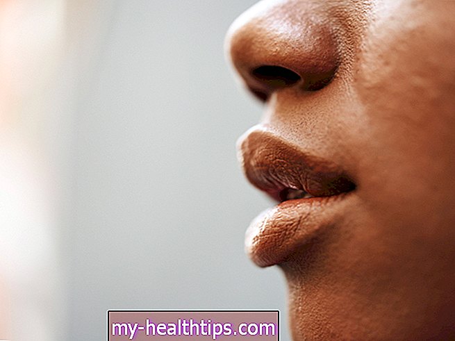 Ar lūpų sriegimas yra saugus ir efektyvus būdas gauti pilnesnes, apibrėžtas lūpas?
