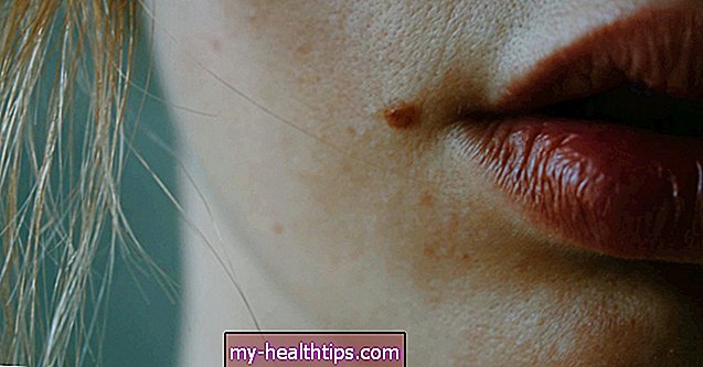 ¿Es la cirugía una forma segura de reducir el volumen de los labios?