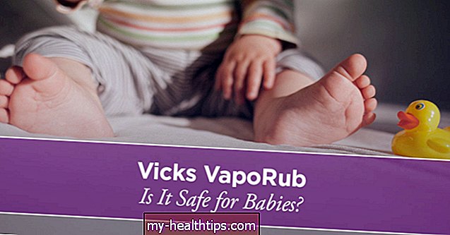 Да ли је Вицкс Вапор Руб сигуран за ноге моје бебе?