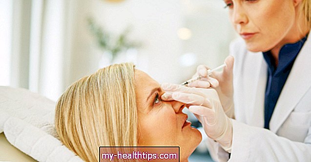 Juvéderm o Botox para las arrugas: diferencias, resultados y costos