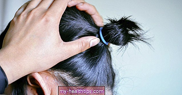 Tratamiento con láser para la caída del cabello