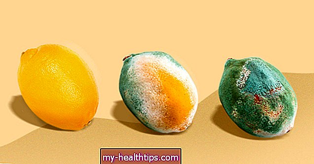 Jugo de limón a ACV: 7 ingredientes caseros que dañan tu piel con el tiempo