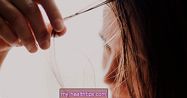 Vilkligė ir plaukų slinkimas: ką galite padaryti