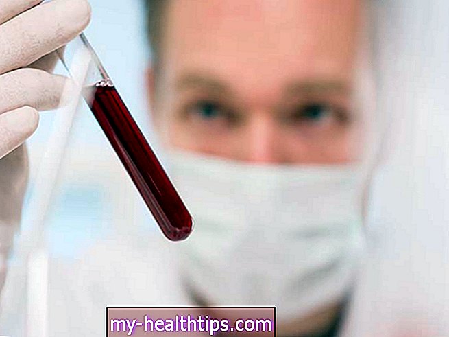 Тест за антитела за лаймска болест