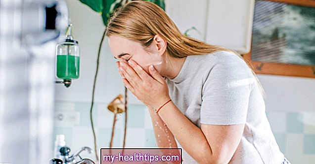 Håndtering af svær acne: Do's and Don'ts