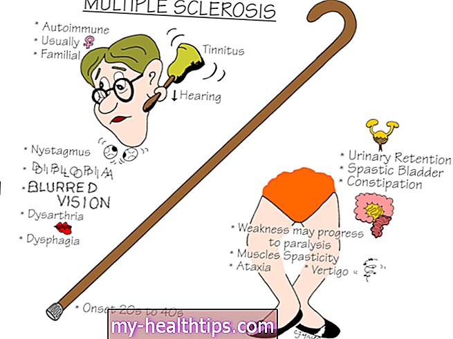 Išsėtinės sklerozės pagrindai