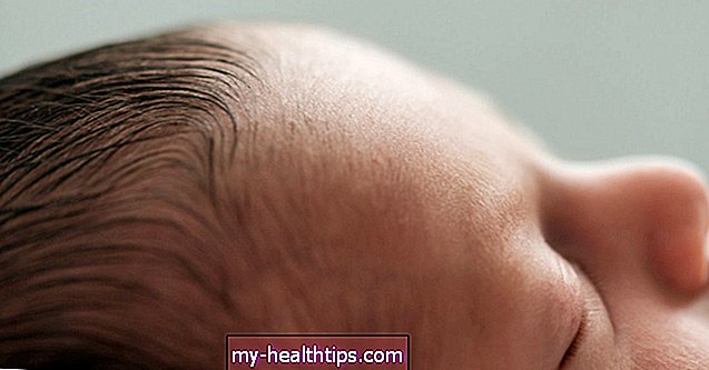 Novorodené vlasy: všade alebo sotva tam, sú to všetko normálne