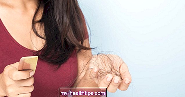 Các lựa chọn cho chứng hói đầu ở phụ nữ và các chứng rụng tóc khác