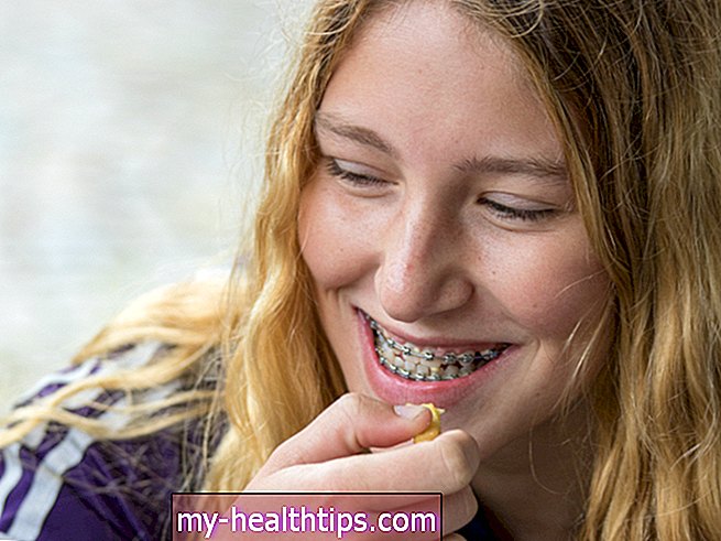 Arnés de ortodoncia: ¿Ayuda a mejorar los dientes?
