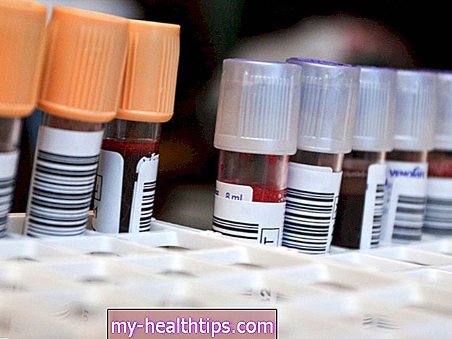Nebenschilddrüsenhormon (PTH) -Test