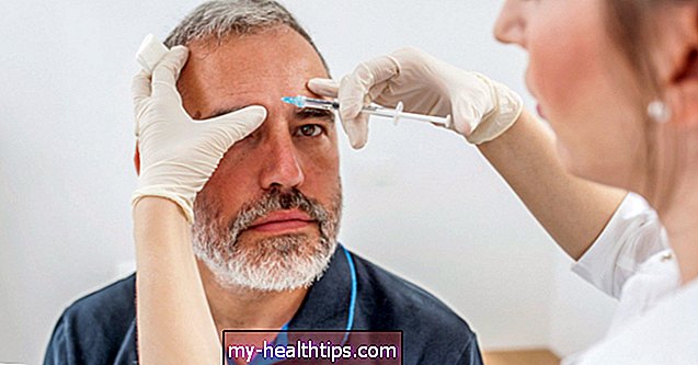 Dosis adecuada para el tratamiento con Botox en la frente, los ojos y la glabela