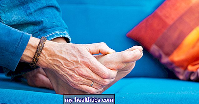 Artritis reumatoide frente a gota: ¿cómo se puede diferenciar?
