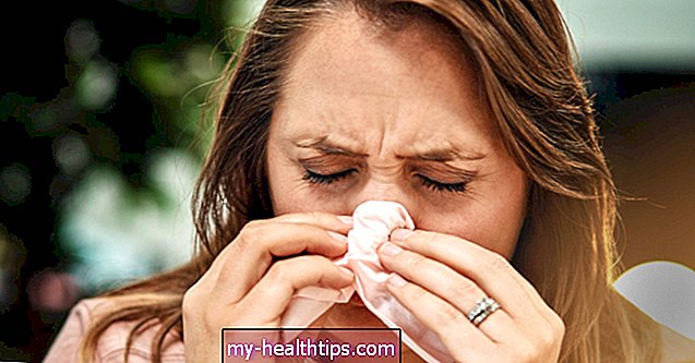 A tipo gripo požymiai ir simptomai