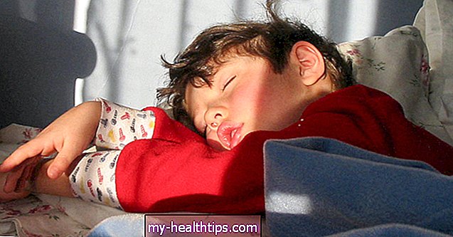 Апнеја током спавања код деце: шта треба да знате