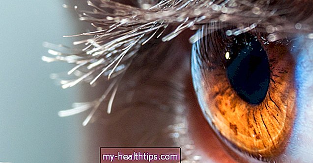 Příčiny oteklé oční bulvy