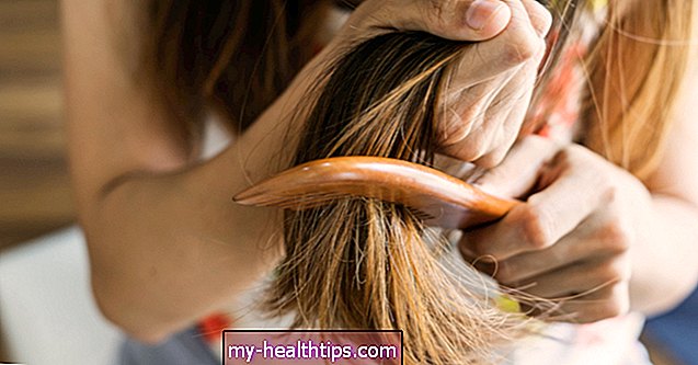 Geriausi aliejai sausiems plaukams gydyti