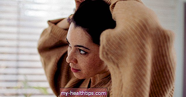 Seborėjinio dermatito ir plaukų slinkimo ryšys