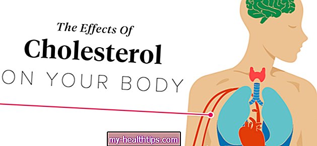 Los efectos del colesterol alto en el cuerpo