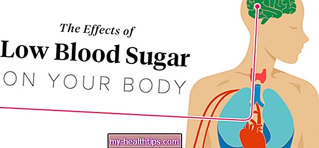 Mažo cukraus kiekio kraujyje poveikis jūsų kūnui