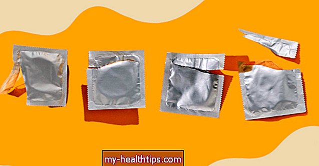 Los condones y métodos de barrera mejor calificados, según los ginecólogos