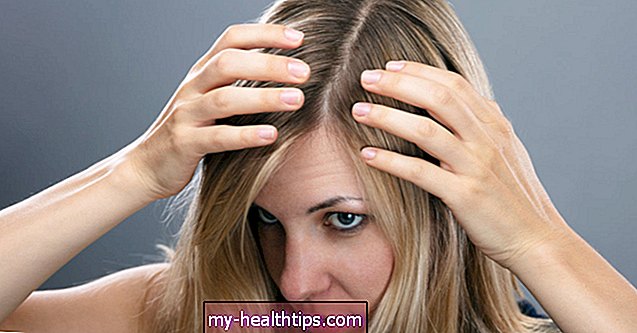 अपने खोपड़ी पर अंतर्वर्धित बाल का इलाज